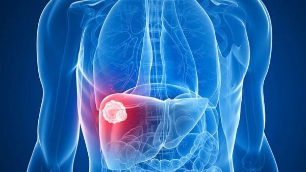 Cải thiện liệu pháp chẩn đoán và điều trị ung thư gan