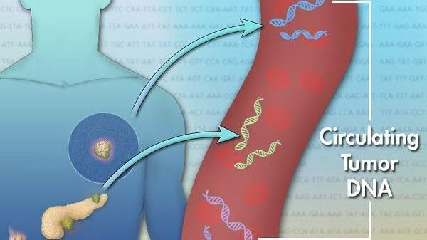 ctDNA: A novel adjuvant biomarker in resectable solid tumors