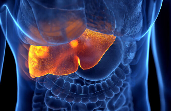 Những nguyên nhân gây suy gan cấp tính tuyệt đối không được phớt lờ!