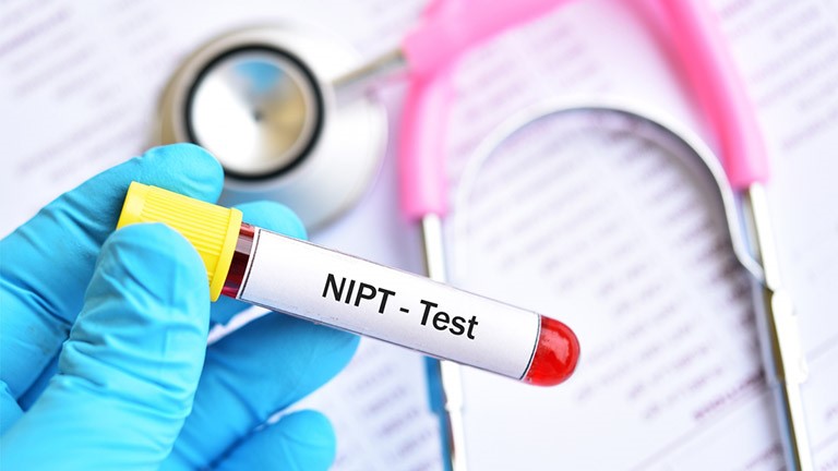 NON-INVASIVE PRENATAL TESTING (NIPT) BY NGS – ILLUMINA