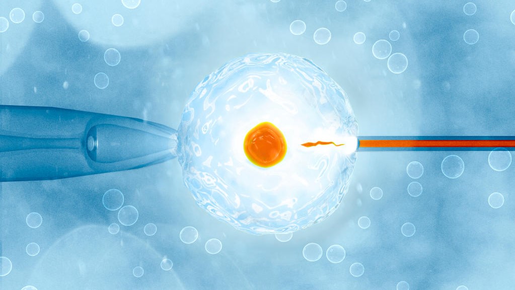 APPLICATION OF NGS–ILLUMINA IN PREIMPLANTATION GENETIC TESTING FOR ANEUPLOIDY PGT-A